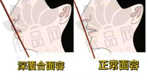 总结