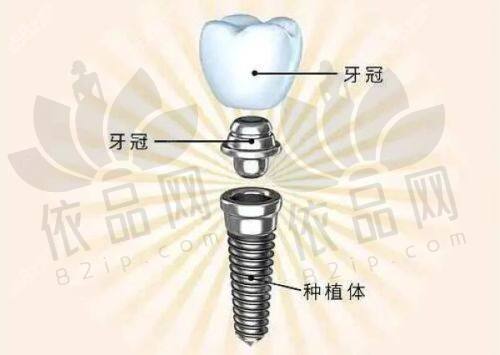 深圳万丰医院口腔科预约挂号全攻略，多种方式任你选，还有紧急看牙妙招