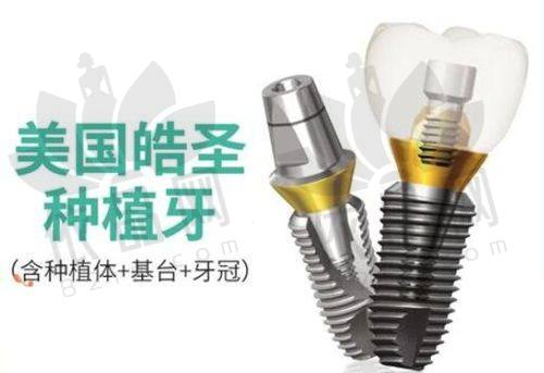 珠海六和口腔医院种牙实例分享