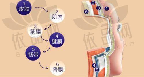 考虑取出埋线的建议