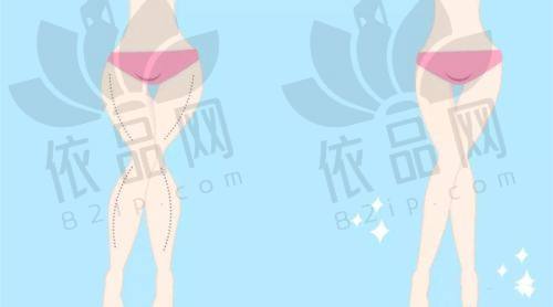 磨骨改脸型及其他整形项目价格参考