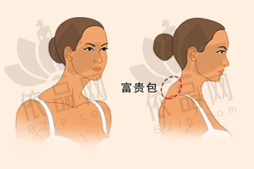 呼和浩特亚太医疗美容医院交通路线
