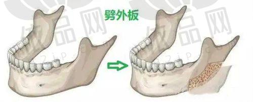 张高贵医生擅长项目
