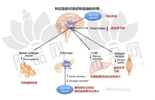 刘正茂医生的技术优势与实例分享