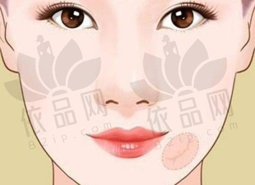 合肥韩美刘冷医生口碑评价