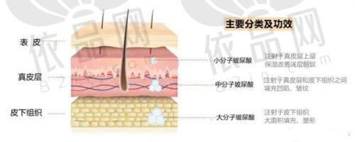 手术治疗去眼袋成效如何？