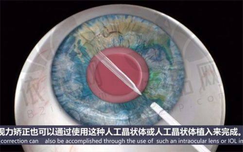 三、深圳爱尔眼科医院部分分院地址信息