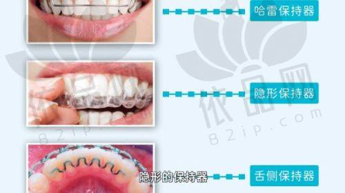 2025赤峰牙冠材料对种植牙价格的影响