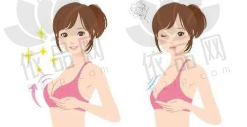 南京美莱整形医院实操实例分享：术后一天可自由活动
