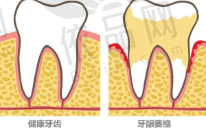 4. 价格因素