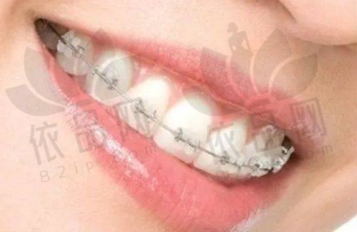 乌鲁木齐口腔医院排名前十