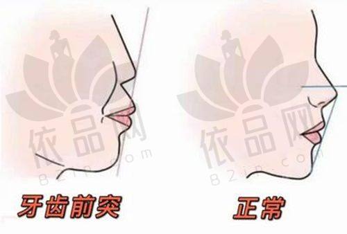 栗伟医生擅长项目