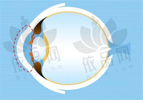 牡丹江爱尔眼科医院交通路线