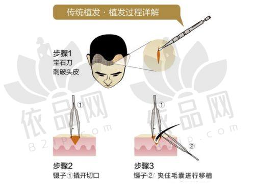 二、南京新生植发医院医生介绍