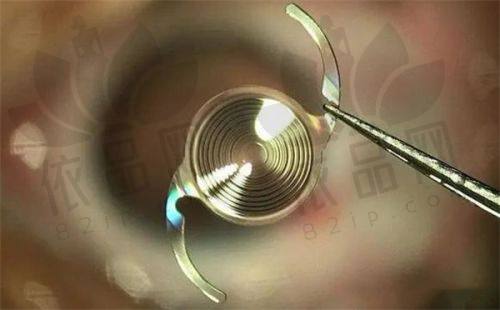 综上所述，广州眼科医院哪家好呢？广州眼科医院排名第一的是广州医院；排名前三的是广州医院、广州视百年眼科、广州爱尔眼科医院。这些都是广州有名的眼科医院，值得大家考虑。