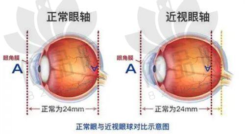 【焦作尖峰眼科医院】简介