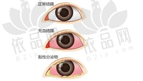 四、广西视光中 心价格透明，服务安心