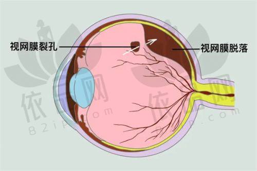 南宁爱尔眼科医院营业时间