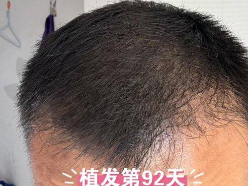 福州比较好的毛发科医院