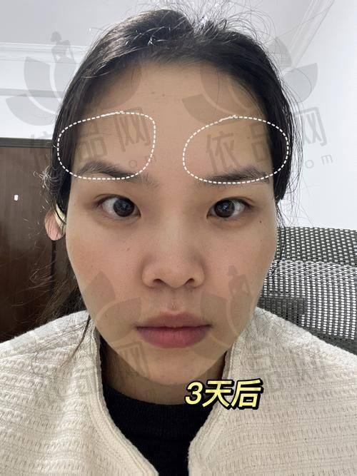 如何选择适合自己的南京华美注射医生