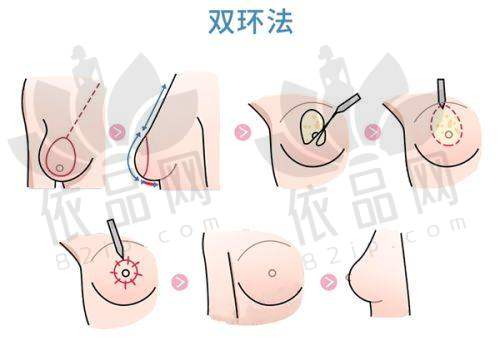 四、黑龙江哈尔滨瑞丽医疗美容医院的具体地址在哪里？