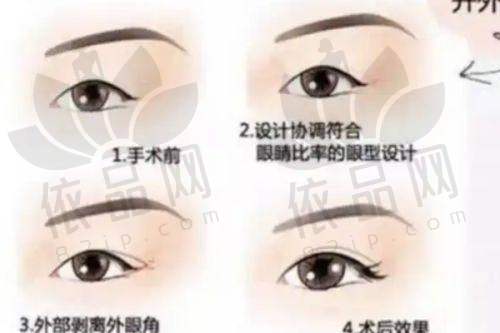 二、注射瘦脸针的原理和优势