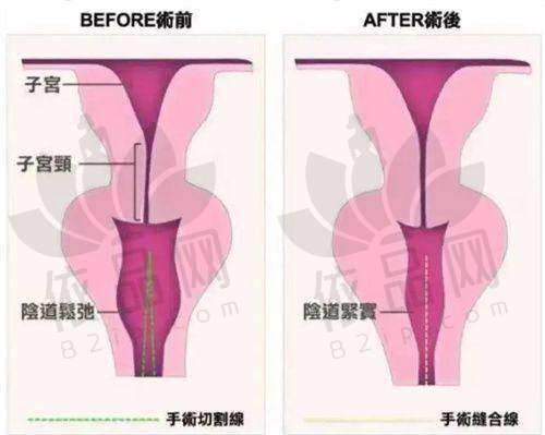 三、重庆美仑美奂擅长什么？