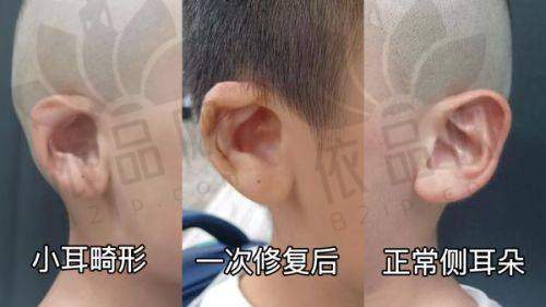 4. 山东滨州方超医学美容