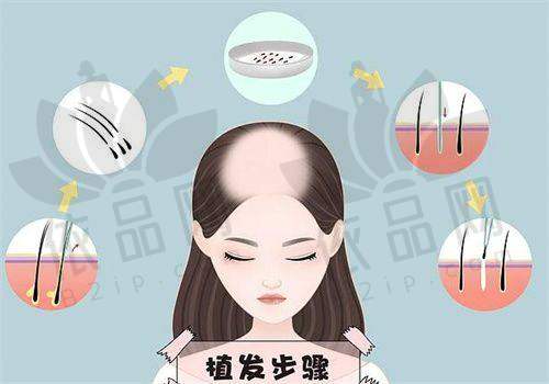 沈阳华美医院植发科医生团队