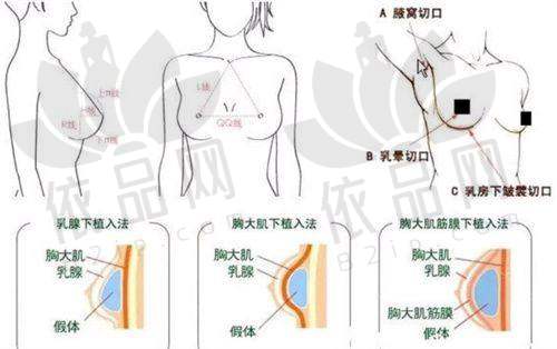 王洪医生三大擅长领域：专治“整坏了”的崩溃脸
