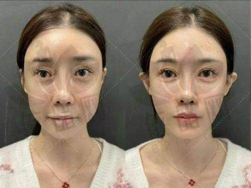 辽宁省人民医院整形外科交通路线