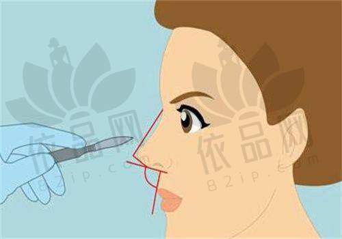 西双版纳整形医院项目特色总结