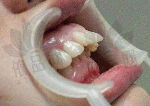 深圳格伦菲尔口腔龙华区8家分院介绍