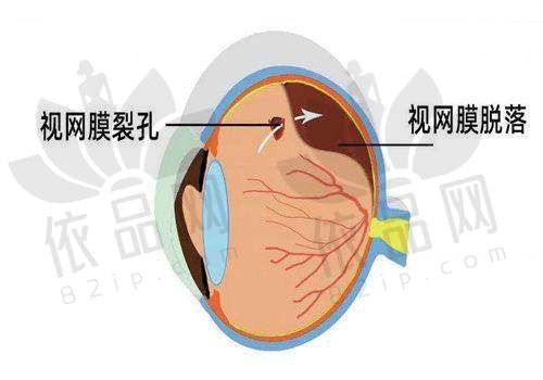 五、九江爱尔眼科医院做近视手术好吗？