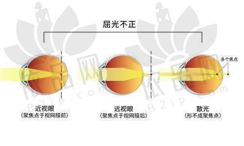 二、评选指标：四大维度筛选国内角膜移植良心医院