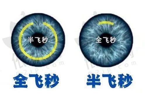 沈阳何氏眼科医院ICL晶体植入手术的医生团队