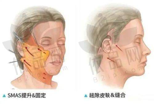 避坑指南：认准正规渠道！黄牛猖獗