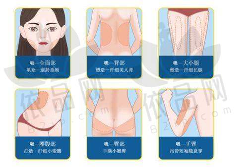 郑州东方整形医院——黄金超光子的理想之选