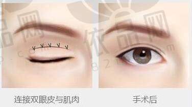 西宁美莱馨怡医院王院长简历