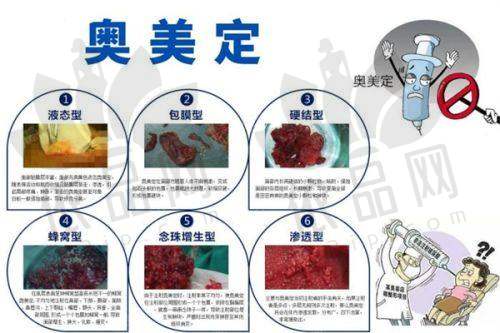 辽宁省人民医院整形外科总结