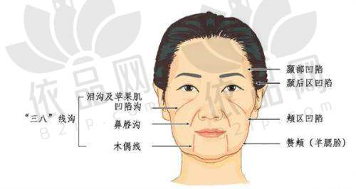 三、济南诺德姚军注射瘦脸针的优势