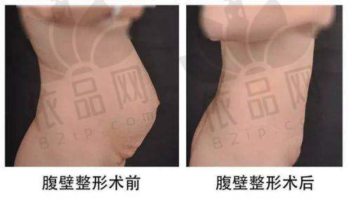 辽宁省人民医院整形外科预约方式