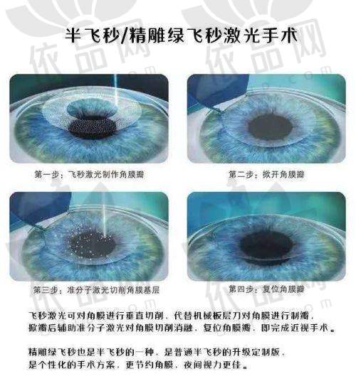 沈阳何氏眼科医院ICL晶体植入手术的优势总结