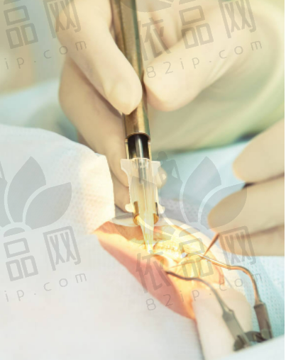 2025成都近视眼手术哪家好？