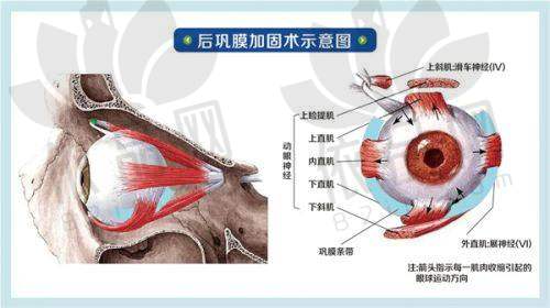 五、王红眼科医生手术价格收费