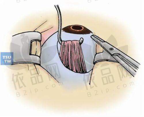 五、角膜病医生