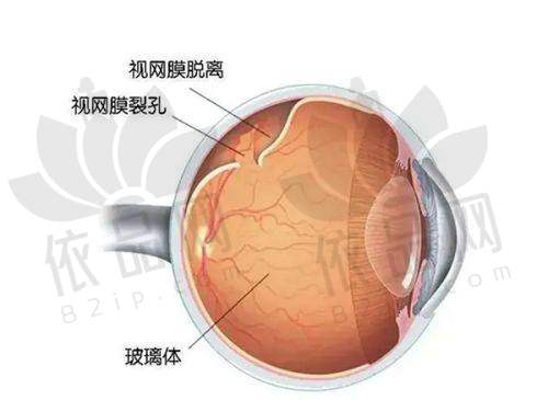 沈阳何氏眼科医院预约方式