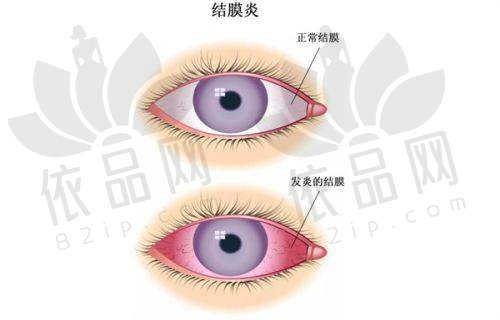 大同朝聚安康眼科医院上班时间