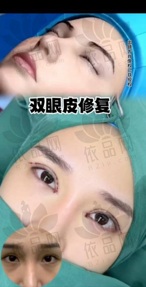 成功实例见证卢尚兵医生的实力