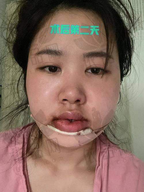 三、北京八大处预约挂号攻略